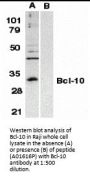 Anti-Bcl-10 Antibody
