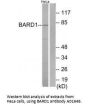 Anti-BARD1 Antibody