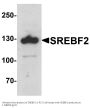 Anti-SREBF2 Antibody