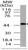 Anti-TRBP TARBP2 Antibody