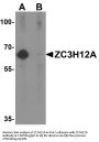 Anti-Endoribonuclease ZC3H12A ZC3H12A Antibody