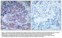 Anti-SEK1/MKK4 (Ab-261) MAP2K4 Antibody
