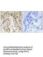 Anti-HCFC1/Hcf1 Antibody