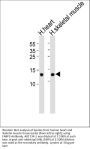 Anti-FABP3 Antibody