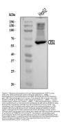 Anti-Liver Carboxylesterase 1/CES1 Antibody Picoband®
