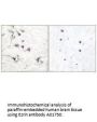Anti-Ezrin Antibody