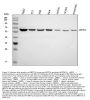 Anti-METTL3 Antibody Picoband®