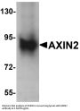 Anti-Axin-2 AXIN2 Antibody