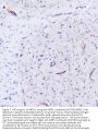 Anti-INPPL1 Antibody Picoband®