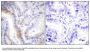 Anti-Urocortin UCN Antibody