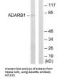 Anti-ADARB1/Red1 Antibody