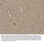 Anti-Kv1.1 potassium channel/KCNA1 Antibody Picoband®