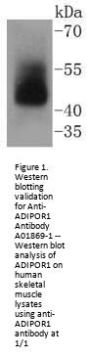 Anti-ADIPOR1 Antibody