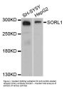 Anti-Sortilin-related receptor SORL1 Antibody