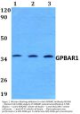 Anti-GPBAR1 Antibody