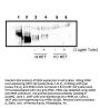 Anti-PERK EIF2AK3 Antibody