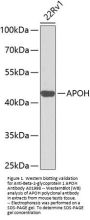 Anti-Beta-2-glycoprotein 1 APOH Antibody