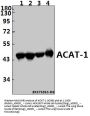 Anti-ACAT1 (K266) Antibody