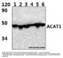 Anti-ACAT1 (K266) Antibody