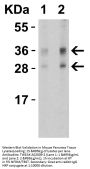 Anti-TWEAK TNFSF12 Antibody