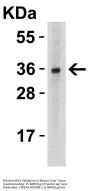 Anti-TWEAK TNFSF12 Antibody