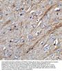 Anti-TWEAK TNFSF12 Antibody
