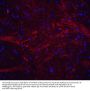 Anti-TWEAK TNFSF12 Antibody