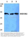 Anti-HSD3B2 Antibody
