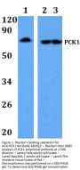Anti-PCK1 Antibody