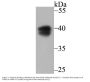 Anti-PON2 Antibody