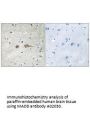 Anti-MADD Antibody