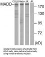 Anti-MADD Antibody