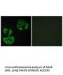 Anti-MADD Antibody
