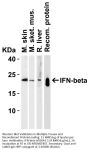 Anti-IFN-beta IFNB1 Antibody