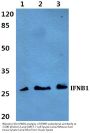 Anti-Interferon beta IFNB1 Antibody