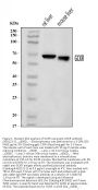 Anti-GCKR Antibody Picoband®