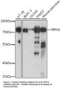 Anti-TRPV6 Antibody