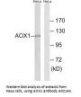 Anti-AOX1/Aldehyde Oxidase Antibody
