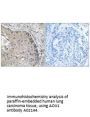 Anti-AOX1/Aldehyde Oxidase Antibody