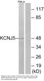 Anti-KCNJ5/Kir3.4 Antibody
