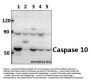 Anti-Caspase 10 CASP10 Antibody