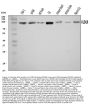 Anti-VLDL Receptor/VLDLR Antibody Picoband®