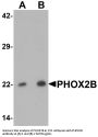 Anti-PHOX2B Antibody