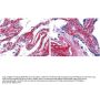 Anti-COLLAGEN Type V COL5A1 Antibody