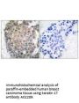 Anti-Keratin 17 KRT17 Antibody