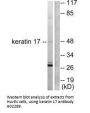 Anti-Keratin 17 KRT17 Antibody