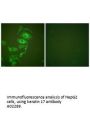 Anti-Keratin 17 KRT17 Antibody