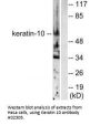 Anti-Keratin 10 KRT10 Antibody