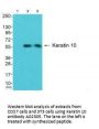 Anti-Keratin 10 KRT10 Antibody