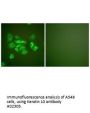 Anti-Keratin 10 KRT10 Antibody